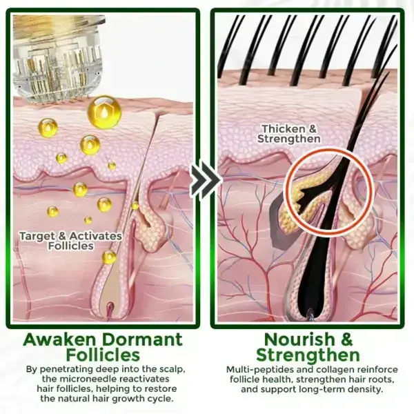 👱♂️ Microneedle Herbal Infusion Hair Stimulation Set - Image 6
