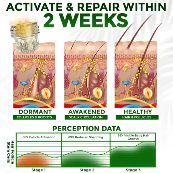 👱♂️ Microneedle Herbal Infusion Hair Stimulation Set - Image 7
