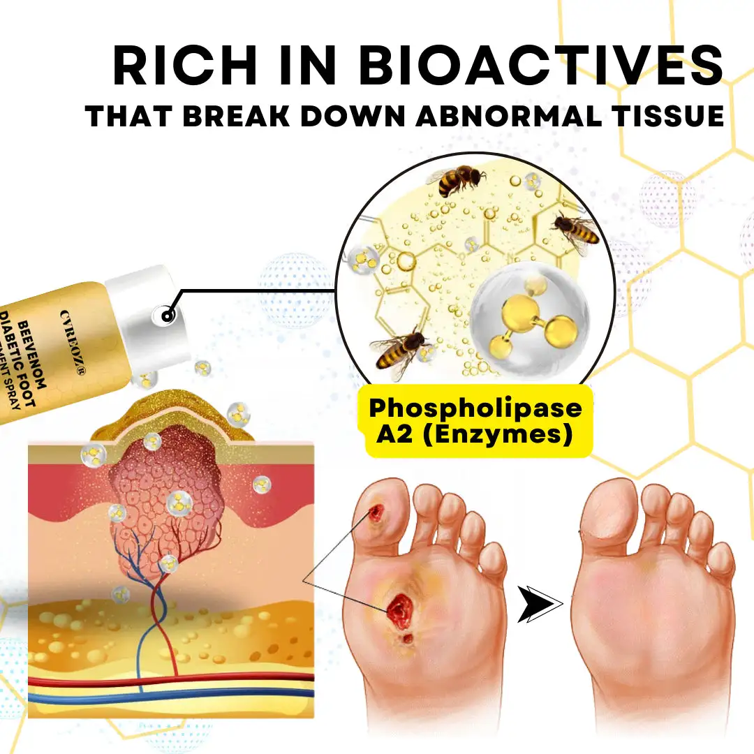 Bee Venom Diabetic Foot Treatment Spray - Image 5