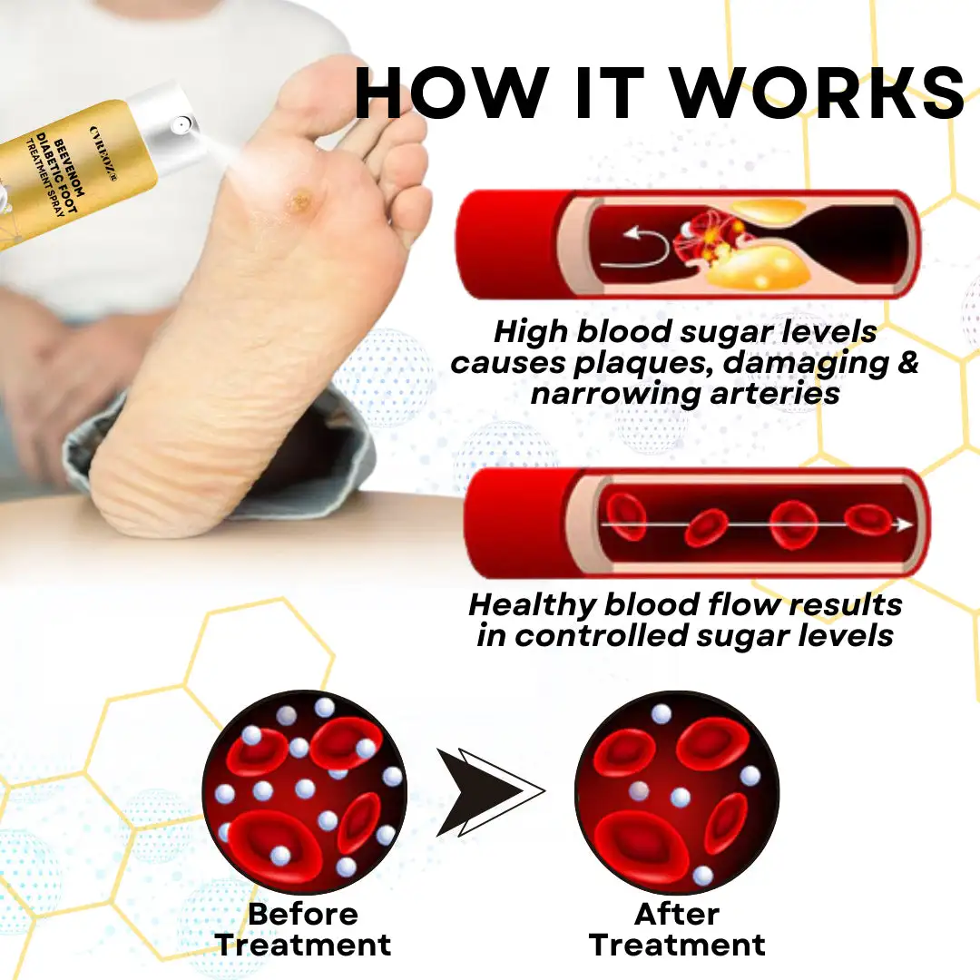 Bee Venom Diabetic Foot Treatment Spray - Image 6