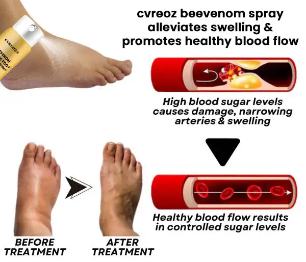 Bee Venom Diabetic Foot Treatment Spray - Image 8