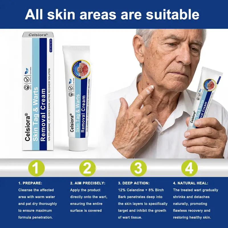 Targeted Skin Tag & Wart Removal Cream – Time-Released Phyto-Exfoliant (12% Celandine ) & Bio-Active Terpene Viral-Inhibitor (8% Thuja) - Image 2