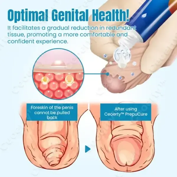 Foreskin Corrector Gel - Image 3