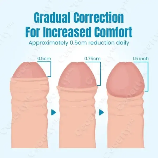 Foreskin Corrector Gel - Image 4