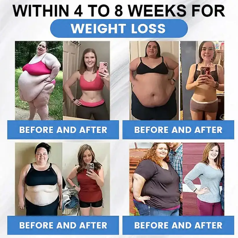 𝑀𝑎𝑦𝑜 𝐶𝑙𝑖𝑛𝑖𝑐 𝑅𝑒𝑐𝑜𝑚𝑚𝑒𝑛𝑑𝑒𝑑 | 𝑂𝑓𝑓𝑖𝑐𝑖𝑎𝑙 𝑆𝑡𝑜𝑟𝑒 | SLIMMING & HEALTHCARE DROPS - 👨⚕️𝑂𝑏𝑒𝑠𝑖𝑡𝑦,𝐶𝑎𝑟𝑑𝑖𝑜𝑣𝑎𝑠𝑐𝑢𝑙𝑎𝑟 𝐷𝑖𝑠𝑒𝑎𝑠, 𝐷𝑖𝑎𝑏𝑒𝑡𝑒𝑠, 𝑆𝑙𝑒𝑒𝑝 𝐴𝑝𝑛𝑒𝑎, 𝐽𝑜𝑖𝑛𝑡 𝑃𝑟𝑜𝑏𝑙𝑒𝑚𝑠 𝑎𝑛𝑑 𝑀𝑜𝑟𝑒 - Image 8