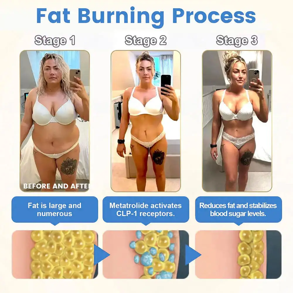 𝑀𝑎𝑦𝑜 𝐶𝑙𝑖𝑛𝑖𝑐 𝑅𝑒𝑐𝑜𝑚𝑚𝑒𝑛𝑑𝑒𝑑 | 𝑂𝑓𝑓𝑖𝑐𝑖𝑎𝑙 𝑆𝑡𝑜𝑟𝑒 | SLIMMING & HEALTHCARE DROPS - 👨⚕️𝑂𝑏𝑒𝑠𝑖𝑡𝑦,𝐶𝑎𝑟𝑑𝑖𝑜𝑣𝑎𝑠𝑐𝑢𝑙𝑎𝑟 𝐷𝑖𝑠𝑒𝑎𝑠, 𝐷𝑖𝑎𝑏𝑒𝑡𝑒𝑠, 𝑆𝑙𝑒𝑒𝑝 𝐴𝑝𝑛𝑒𝑎, 𝐽𝑜𝑖𝑛𝑡 𝑃𝑟𝑜𝑏𝑙𝑒𝑚𝑠 𝑎𝑛𝑑 𝑀𝑜𝑟𝑒 - Image 9