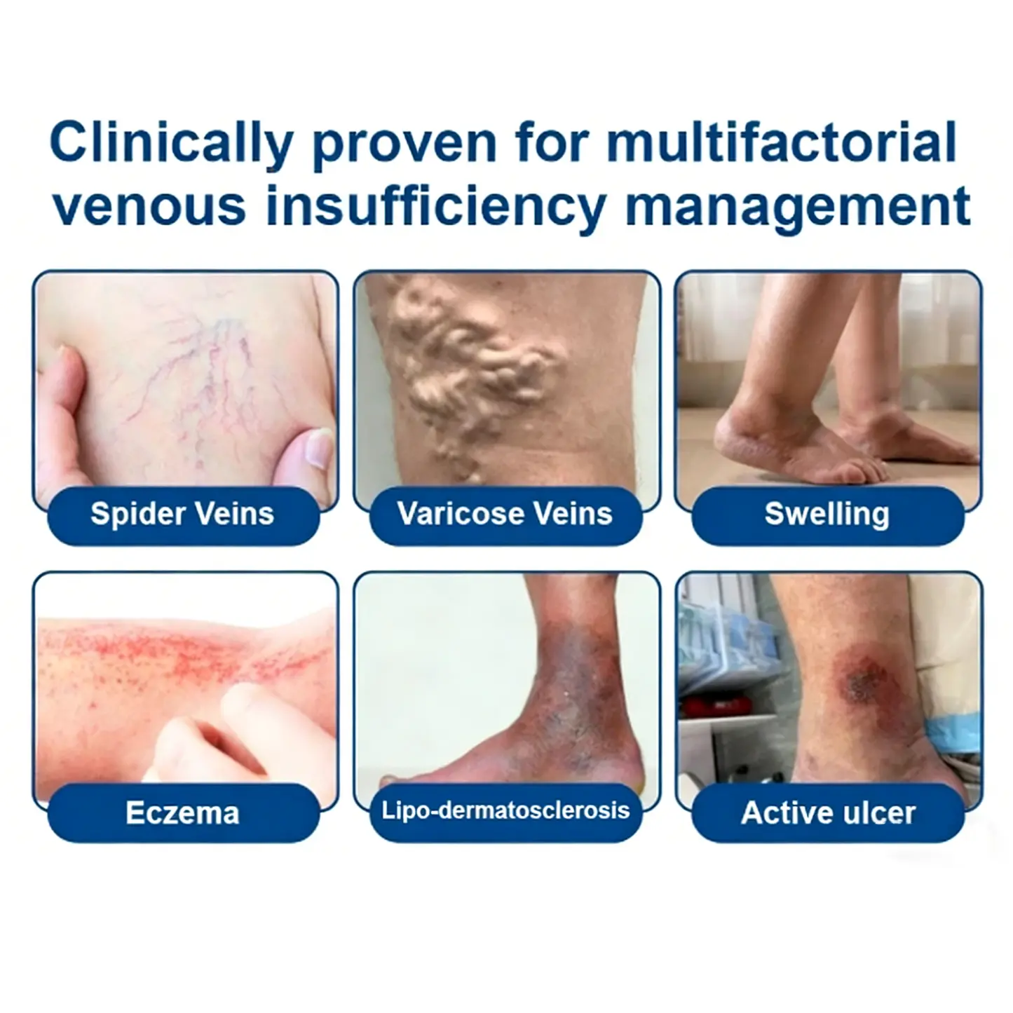 Vein Contour Microneedle - Image 3