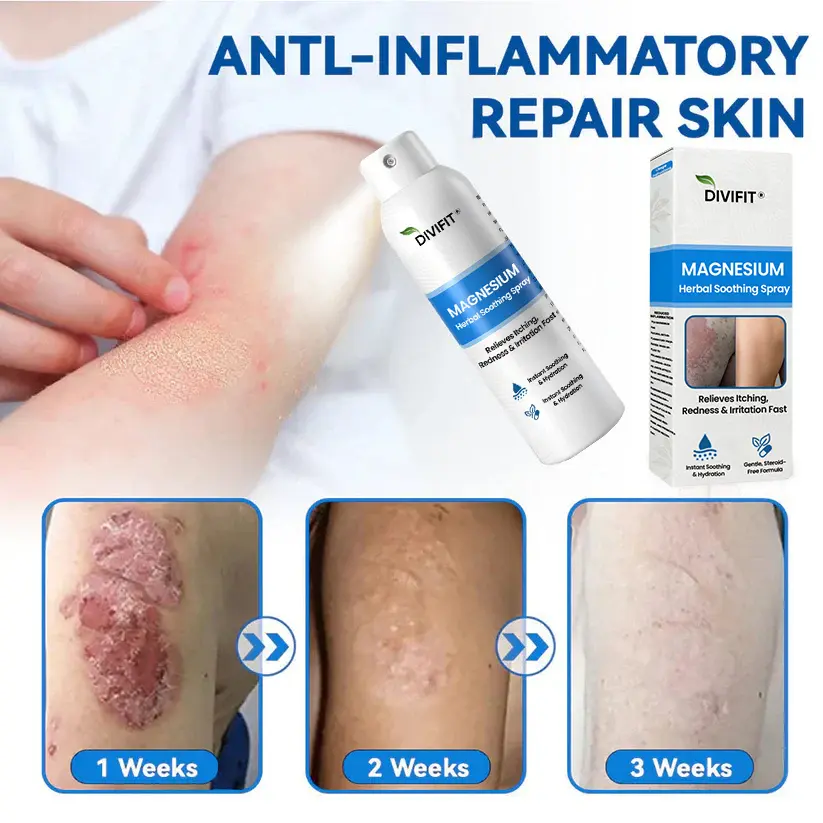 Magnesium Herbal Psoriasis Spray - Image 2