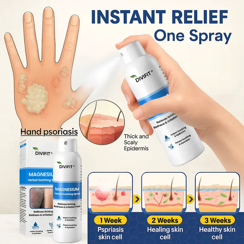 Magnesium Herbal Psoriasis Spray - Image 7