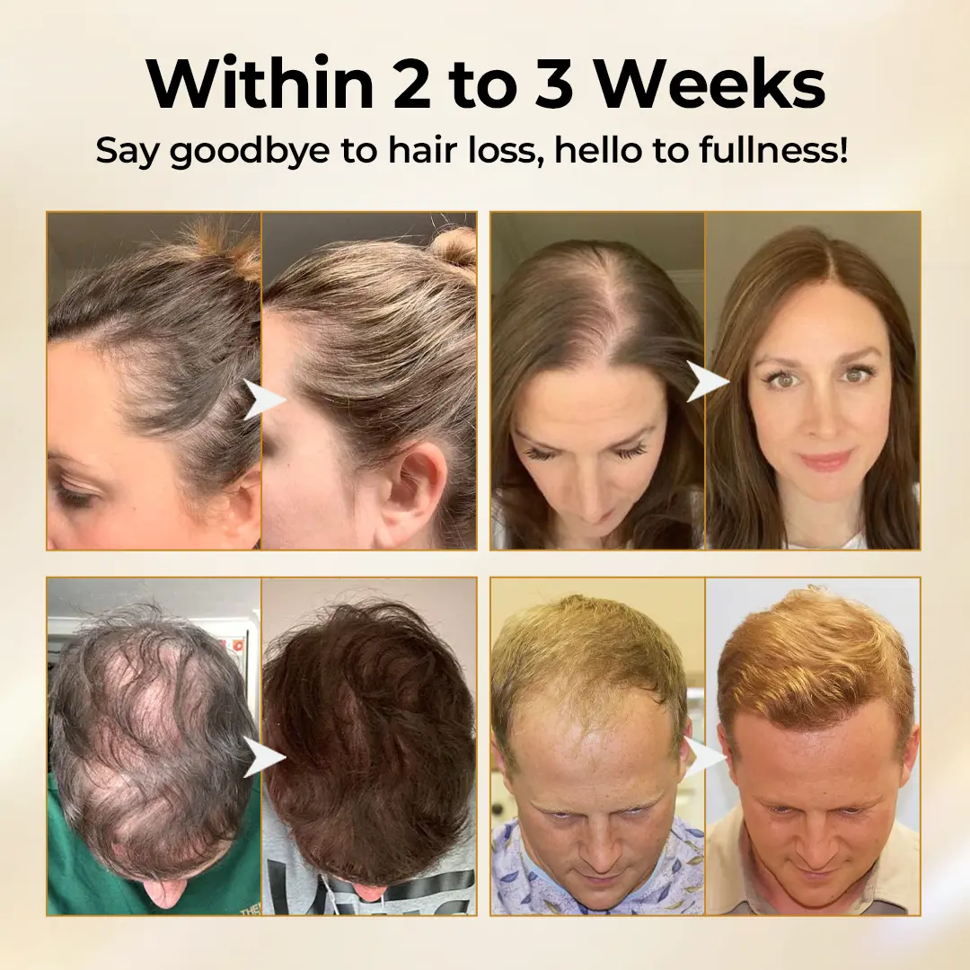 CollagenGrow Peptides Hair Growth Spray - Image 3