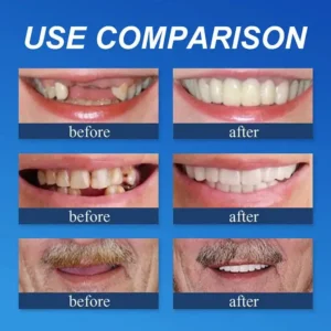 Ends Today: 70% OFF! ⏰ Full Denture with Strong Suctiond Custom-Fit Full Functional Dentures🦷 - Image 6