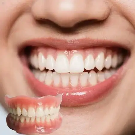 Ends Today: 75% OFF! Full Denture with Strong Suctiond Custom-Fit Full Functional Dentures🦷 - Image 2