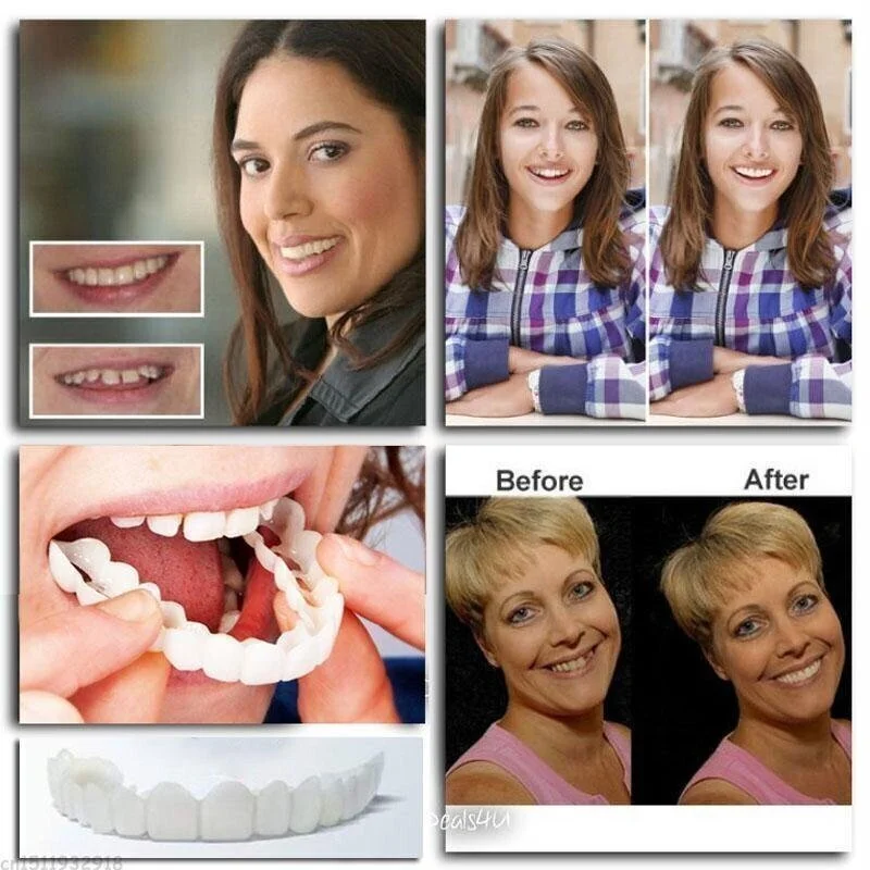 FLASH SALE: Fix Your Smile in 30 Seconds — 👨⚕Adjustable SnapOn Dentures😁 - Image 9