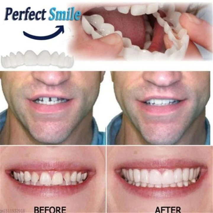 FLASH SALE: Fix Your Smile in 30 Seconds — 👨⚕Adjustable SnapOn Dentures😁 - Image 8