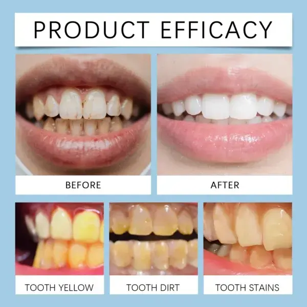 Feimuko Tooth Defense Serum with Nano Hydroxyapatite for Teeth Whitening and Deep Cleaning - Image 8