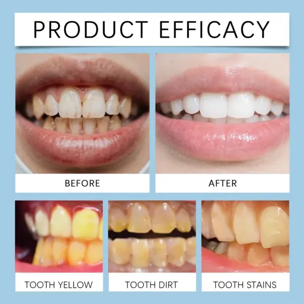 Feimuko Tooth Defense Serum with Nano Hydroxyapatite for Teeth Whitening and Deep Cleaning - Image 8