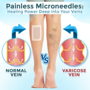 VenaRestore MicroNeedle Vein Repair Patch - Image 2