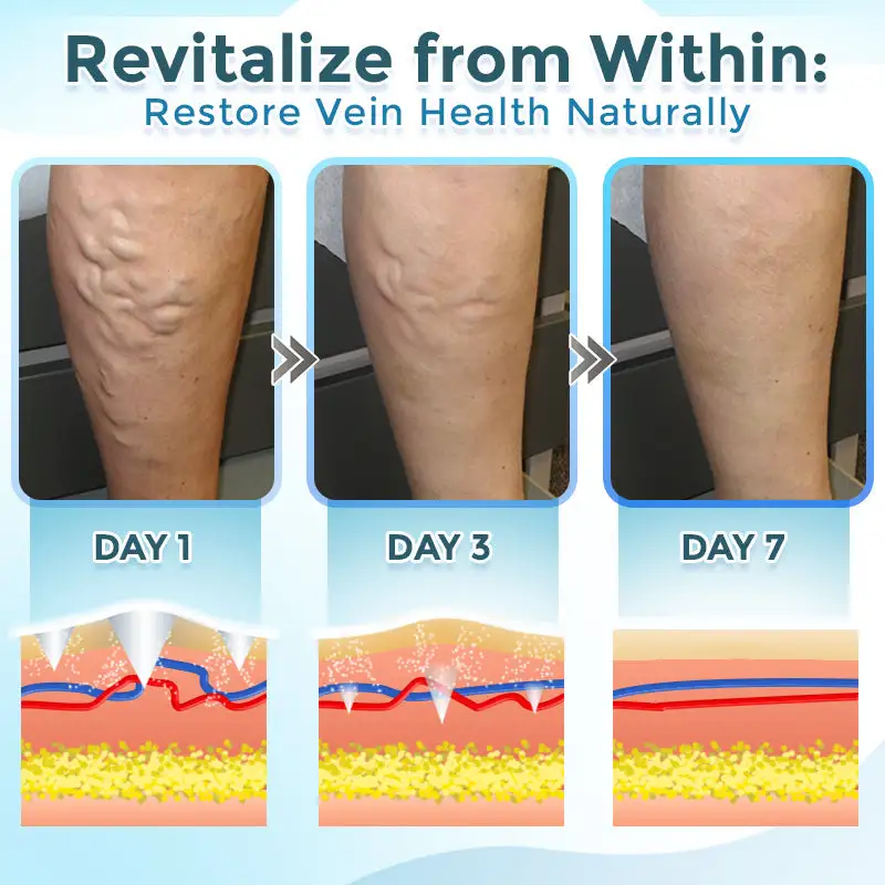 VenaRestore MicroNeedle Vein Repair Patch - Image 3
