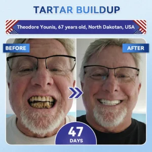 Tooth & Gum Repair - Image 4