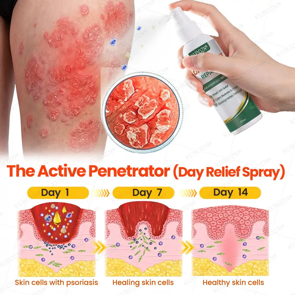 Psoriasis Day & Night Repair System - 100% Steroid-Free Relief Duo for Plaques, Scaling & Itch - Image 2