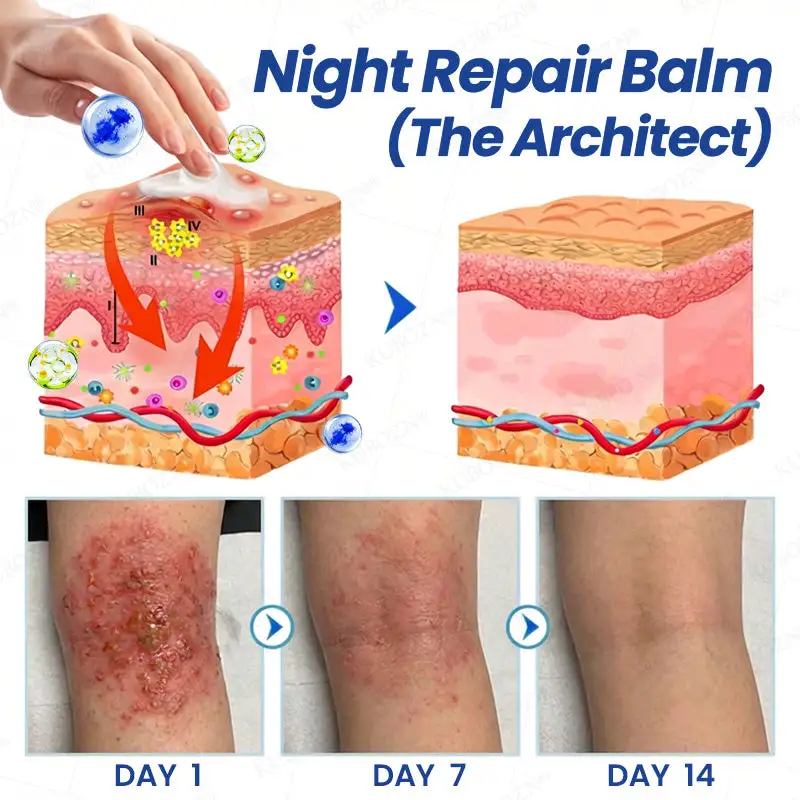 Psoriasis Day & Night Repair System - 100% Steroid-Free Relief Duo for Plaques, Scaling & Itch - Image 3