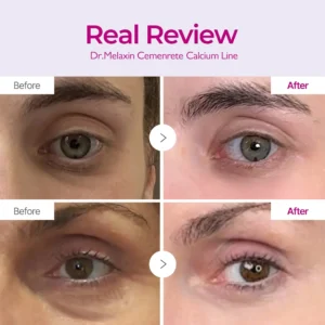 ✨ LAST DAY BUY 1 GET 1 FREE✨Cemenrete Calcium Dark Spot Eye Cream | Dark Circle, Anti-aging, Sagging, Elasticity - Image 12