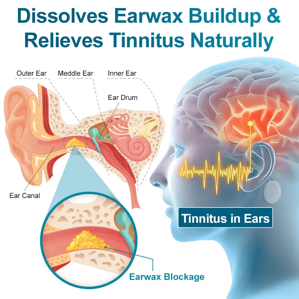 EaseHear Instant Hearing Support & Tinnitus Relief Patches - Image 8