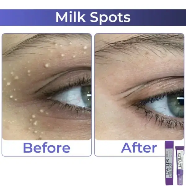 LOVILDS Retinol Intense Advanced Triple Action Eye Cream - Image 13
