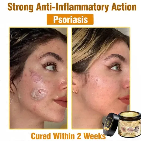 7-Day Rapid Skin Rapair Cream US Dermatologist Approved - Image 3