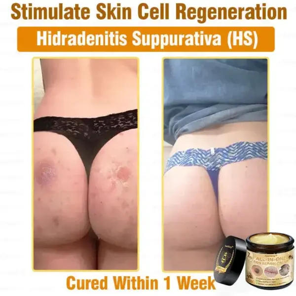 7-Day Rapid Skin Rapair Cream US Dermatologist Approved - Image 6