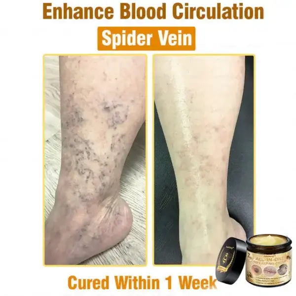 7-Day Rapid Skin Rapair Cream US Dermatologist Approved - Image 7