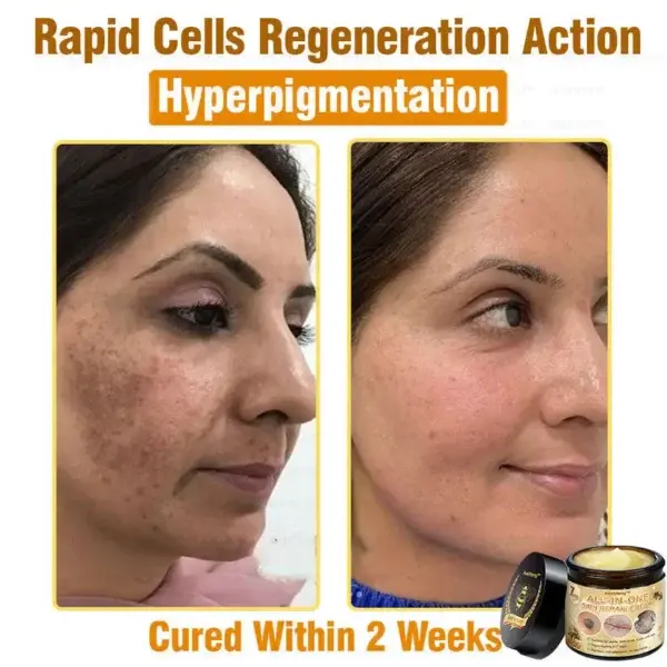 7-Day Rapid Skin Rapair Cream US Dermatologist Approved - Image 9