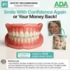 Custom-Fit Full Functional Dentures