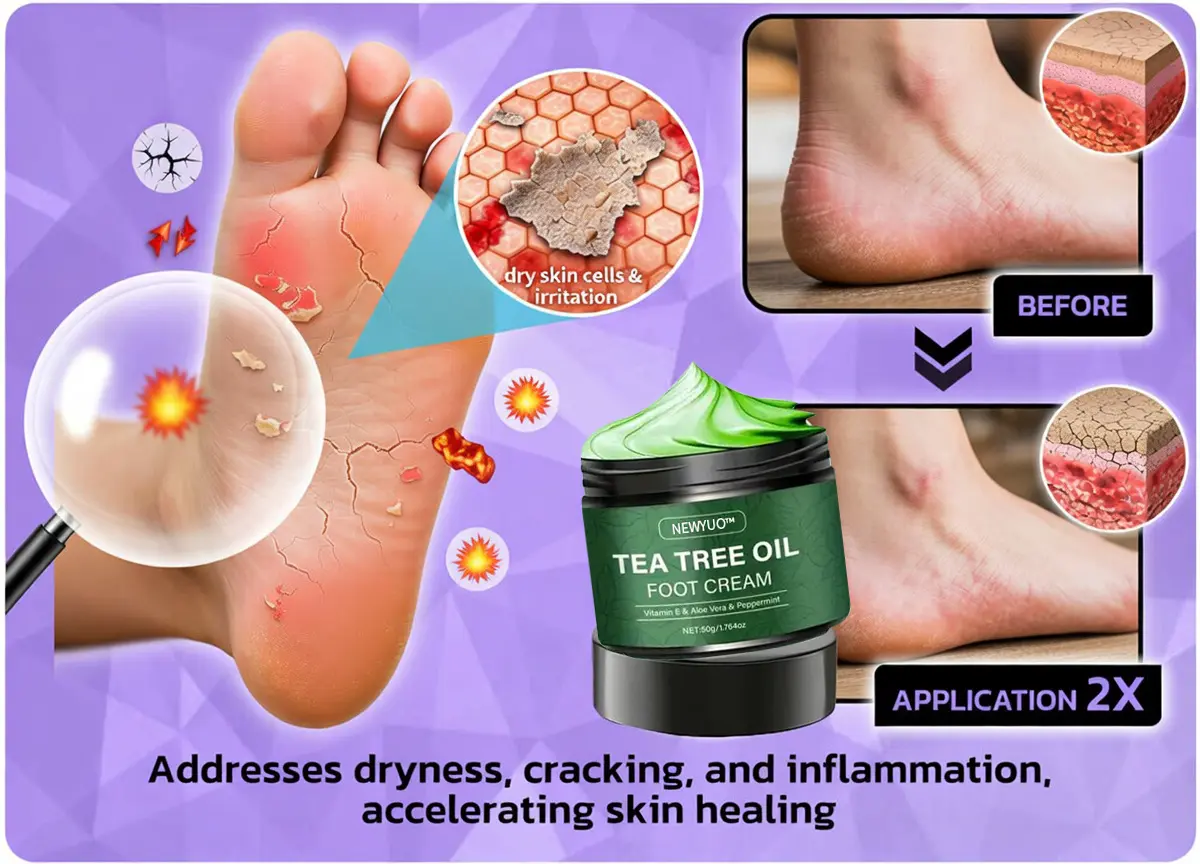 🎁 Limited-Time Offer 🎁 - Don't miss out!Tea Tree Oil Foot Cream (Repairs Dry Cracked Heels, Soothes Tired Feet, Eliminates Odor & Restores Soft Skin) - Image 12