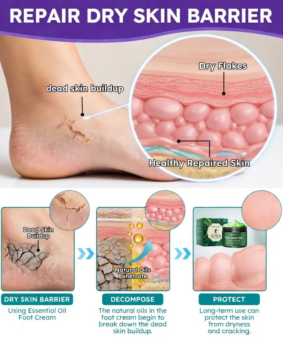 🎁 Limited-Time Offer 🎁 - Don't miss out!Tea Tree Oil Foot Cream (Repairs Dry Cracked Heels, Soothes Tired Feet, Eliminates Odor & Restores Soft Skin) - Image 9