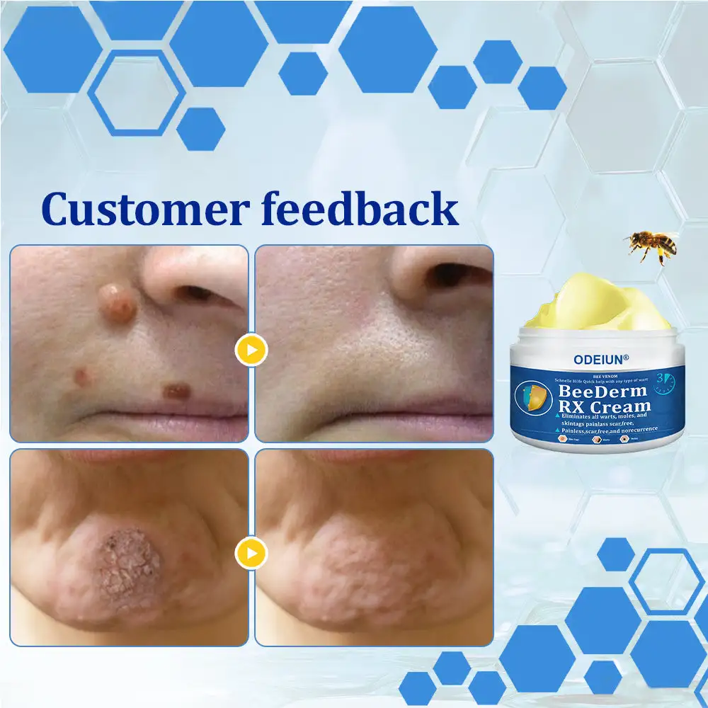 BeeDerm RX Cream - Image 19