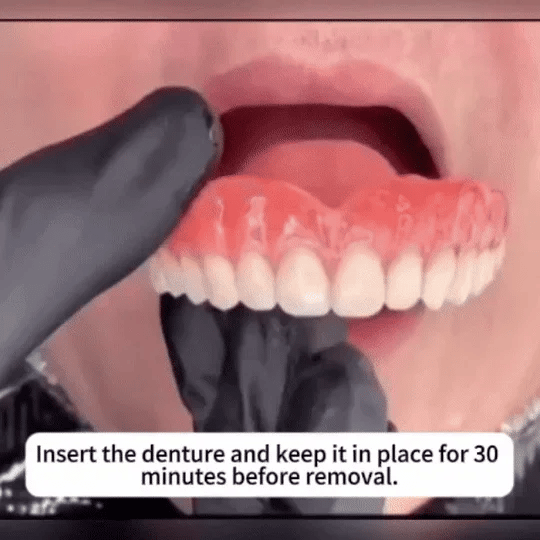 【OFFICIAL Custom-Fit Full Functional Dentures - Image 10