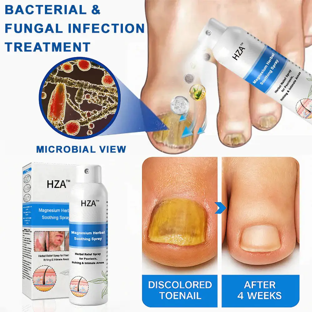 Magnesium Herbal Psoriasis Spray - Image 13