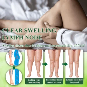 VeinoRoll Therapy Edema Comfort Cream - Image 8