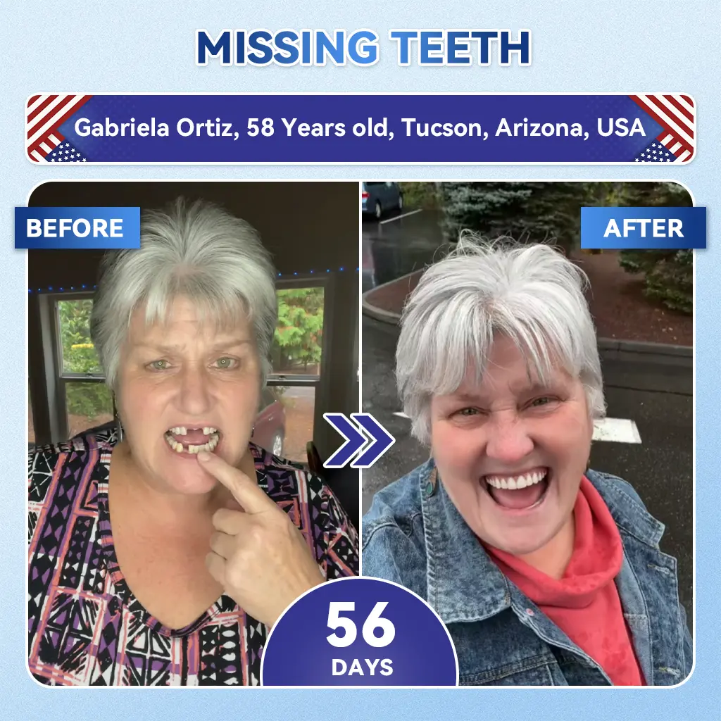 🦷 Tideglusib Fast‑Dissolving Tooth & Gum Repair Oral Strips 😁 (Supports tooth repair and helps relieve gum discomfort and other common oral concerns)