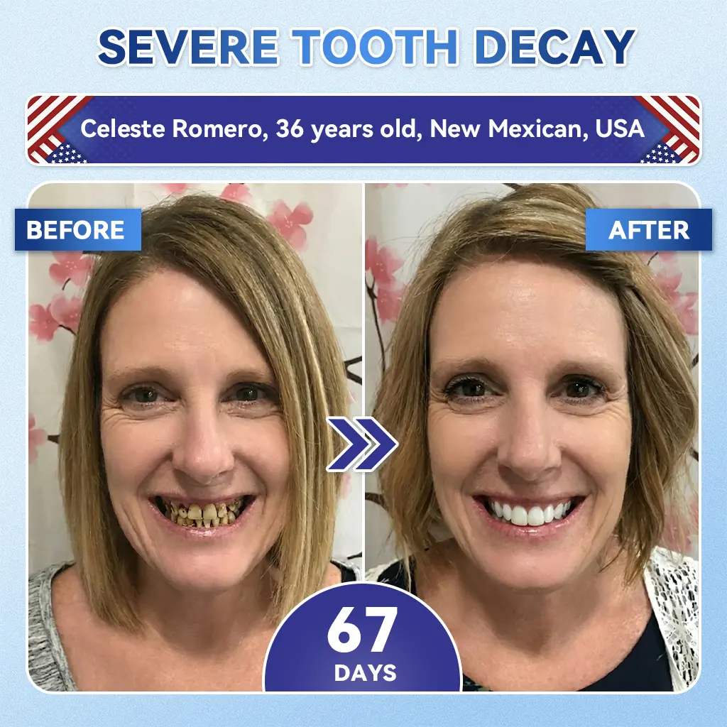 🦷 Tideglusib Fast‑Dissolving Tooth & Gum Repair Oral Strips 😁 (Supports tooth repair and helps relieve gum discomfort and other common oral concerns) - Image 5