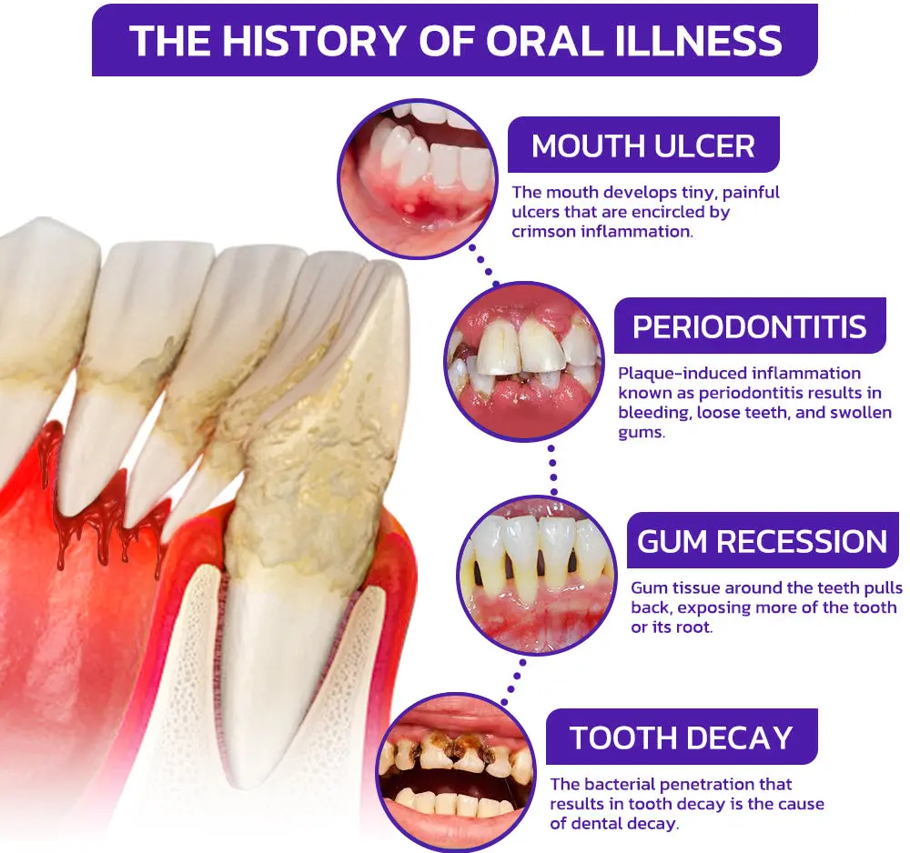 VioGloss Bee Venom Dental Therapy Oral Power🦷 - Image 8