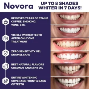 Novora Purple Teeth Whitening Strips - Image 9