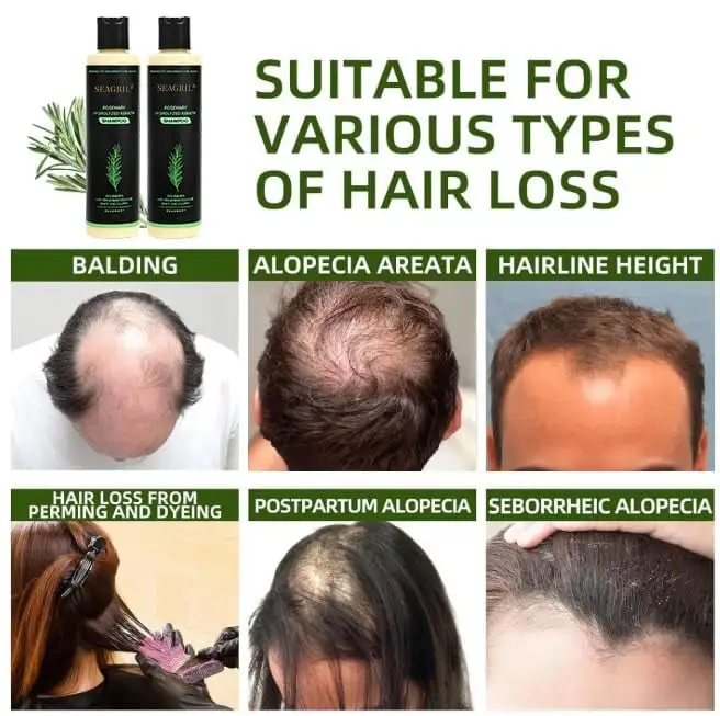 Organic Rosemary Hair Growth Shampoo - Image 7
