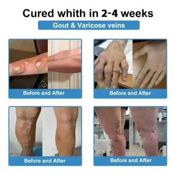 NanoMicroneedle Joint Patch - Image 4