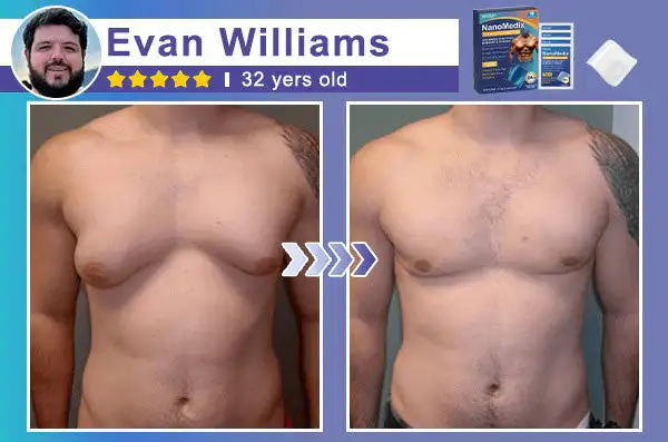 Gynecomastia Chest Fatburn & Firm Patch - Image 6