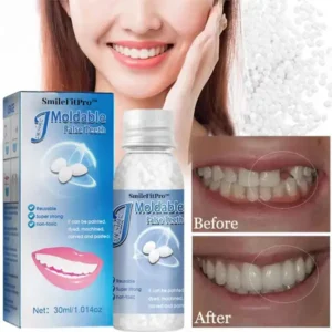 Alternative view of 🦷 Dental Filling Gel – Pain-Free, Drill-Free Cavity Solution💖💖