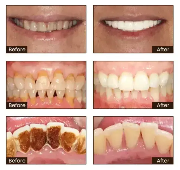Niacinamide Whitening Toothpaste - Image 14