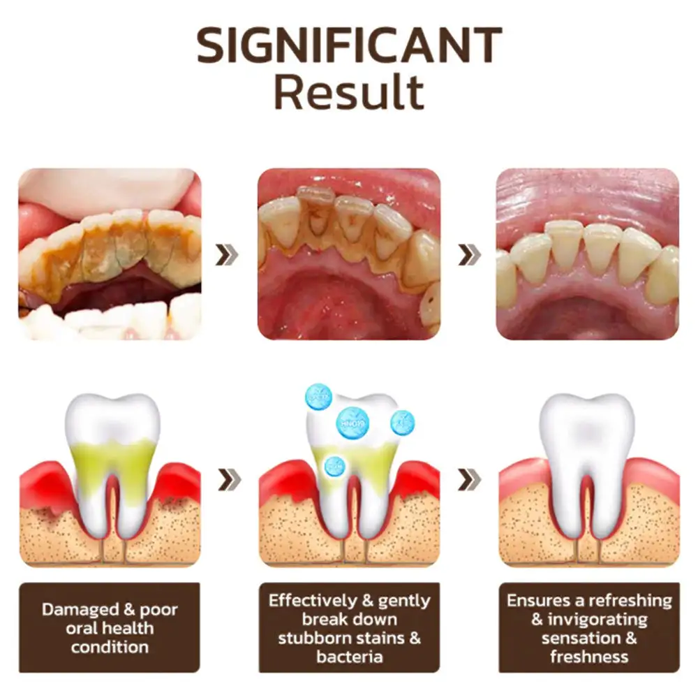 Niacinamide Whitening Toothpaste - Image 15