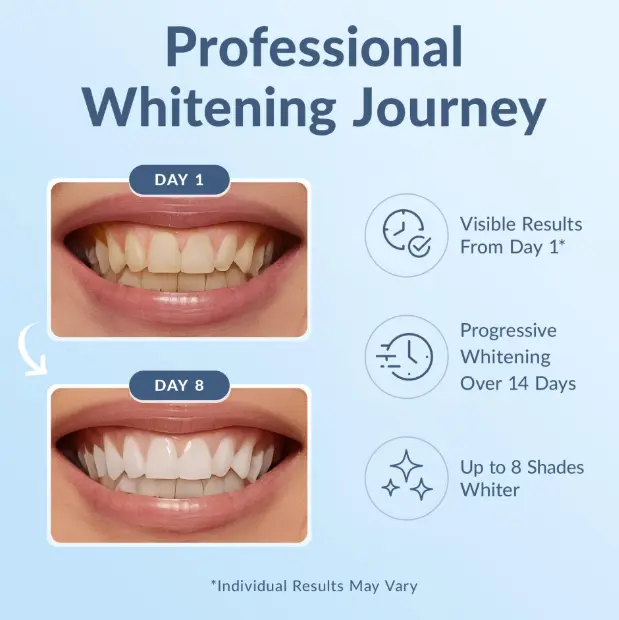 Teeth Whitening Strips - Image 5